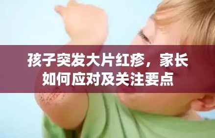 孩子突发大片红疹,家长如何应对及关注要点